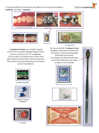 MY TEETH .... AL DENTE ! (OR HOW ORAL MEDICINE - DENTAL IS SEEN THROUGH THE TOOTH) – sheet 25