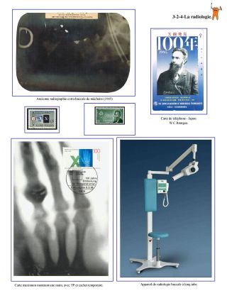 MY TEETH .... AL DENTE ! (OR HOW ORAL MEDICINE - DENTAL IS SEEN THROUGH THE TOOTH) – sheet 45